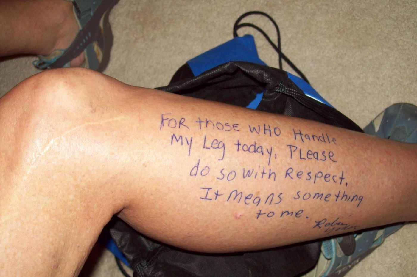 Robin Yoder: A message to her surgical team